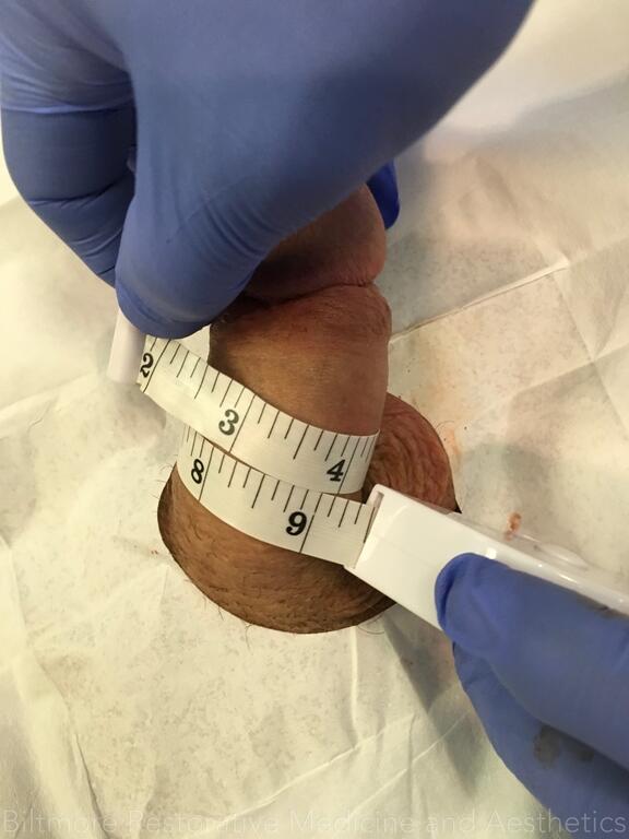 Enhancement_after_02