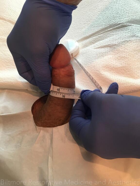 Enhancement_before_01