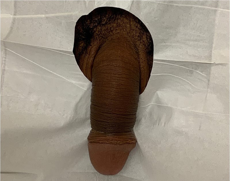 Enhancement_before_09