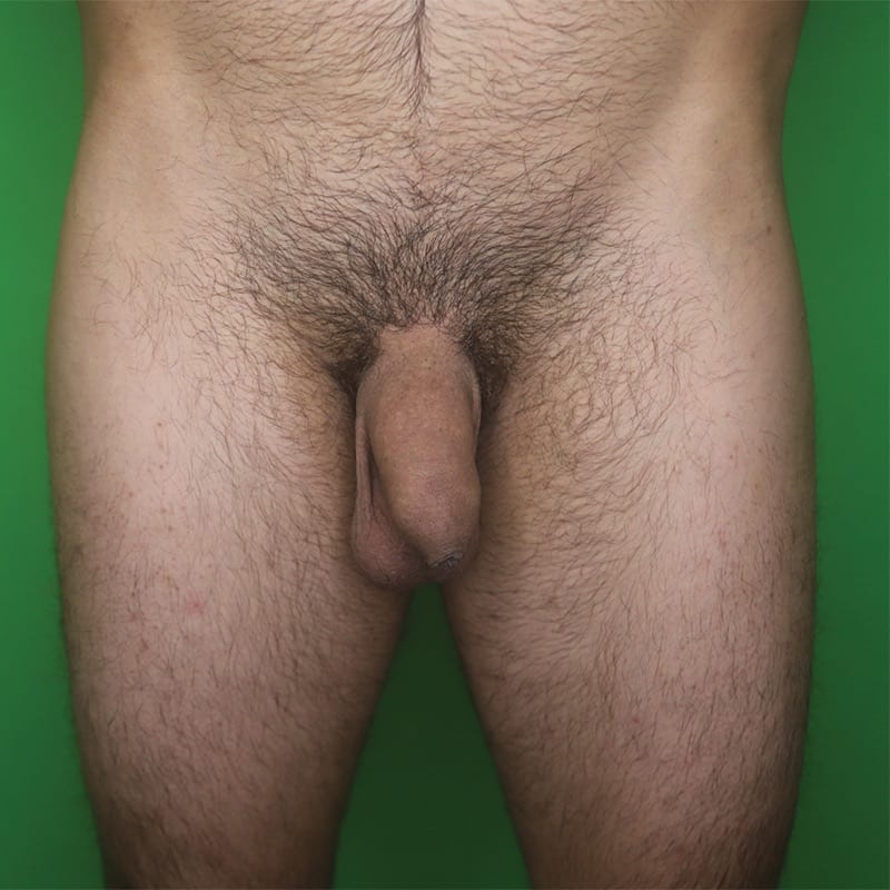 Enhancement_before_12